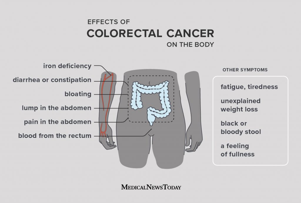 Bowel Cancer or Colorectal cancer