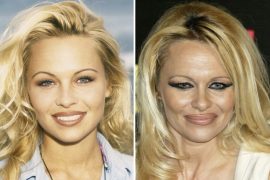 Pamela Anderson Then And Now: Unrecognizable Pam Anderson Now