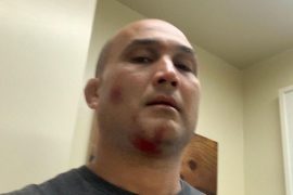 Is BJ Penn Dead? Death Hoax Debunked