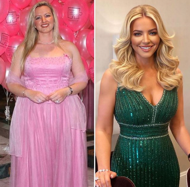 Before and After photo of Michelle Moan