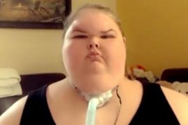 Tammy 1000 lb Sisters Now, Age, Instagram, Weight, Forehead, Hospital, Net Worth, Weight Loss, Dead