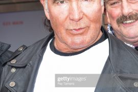 Scott Hall Heart Attack: How is the retired American professional wrestler doing now?