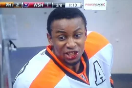 Wayne Simmonds Teeth: How many teeth is Wayne Simmonds missing? How did Wayne Simmons lose his teeth?