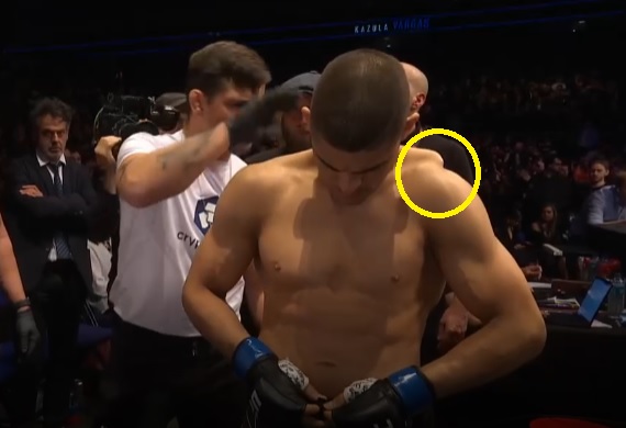 Kazula Vargas Shoulder