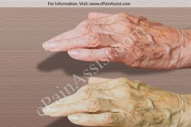 Rigor Mortis: What are the 3 stages of rigor mortis? How long after death is rigor mortis?