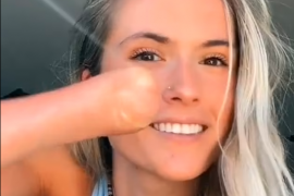 Is Kristie Sita missing a hand?