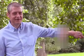 Malcolm MacDonald: Man Who Lost Penis Has New One That Was Built on Arm
