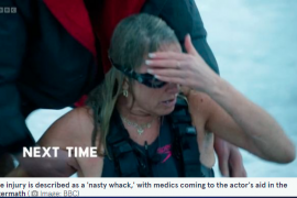 Tamzin Outhwaite Head Injury