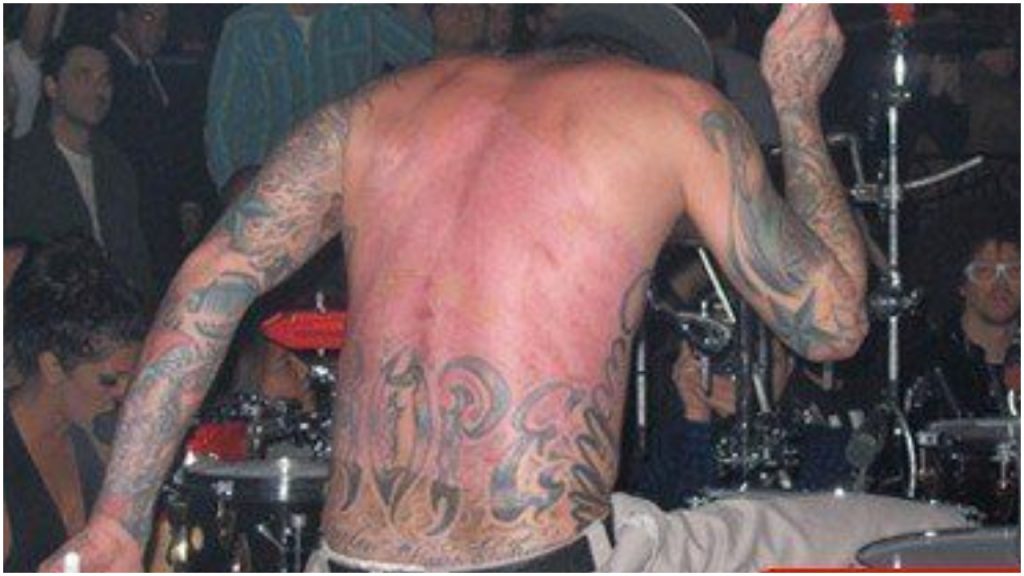 Travis Barker Scars 