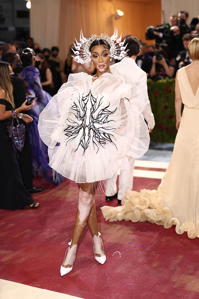 Winnie Harlow