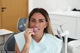 Katie Price Teeth: Does Katie Price have real teeth?