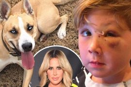 What happened to Kash on Don’t be tardy? How did Kash get bitten by a dog?