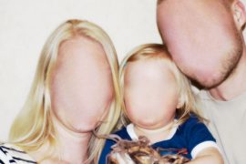 Prosopagnosia: What Do They See? What do people with prosopagnosia see?