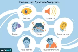 Is there a cure for Ramsay Hunt Syndrome? Can you recover from Ramsay Hunt? Does Ramsay Hunt syndrome ever go away?