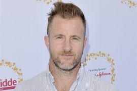 Scott Caan health problems: Did Scott Caan have elbow surgery? How did Scott Caan get hurt?