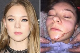 Taylor Hickson Car Accident