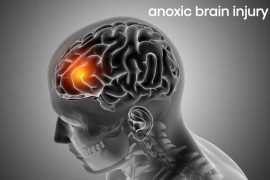 Is Anoxic Brain Damage Permanent?