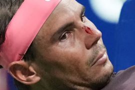 Did Nadal break his nose? How did Nadal hurt his nose?