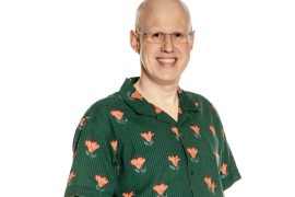 Does Matt Lucas have hair loss?
