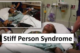 Does stiff person syndrome affect speech?