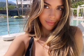 Ekin-Su Cülcüloğlu Plastic Surgery: Did Ekin-Su get plastic surgery?