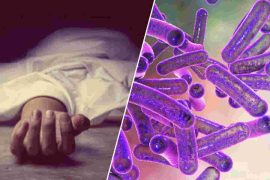 How do you control Shigella? What is the recovery for Shigella?