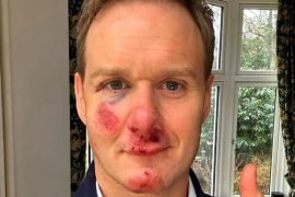 Dan Walker Bike Accident: What Happened To Former BBC Presenter Dan Walker?