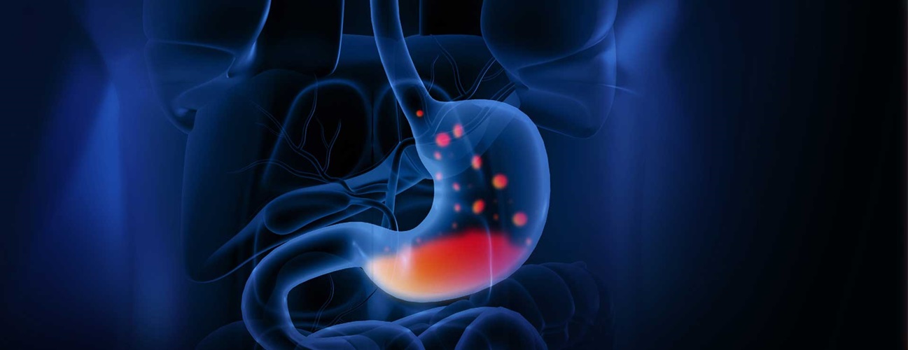 What are the symptoms of laryngopharyngeal reflux?