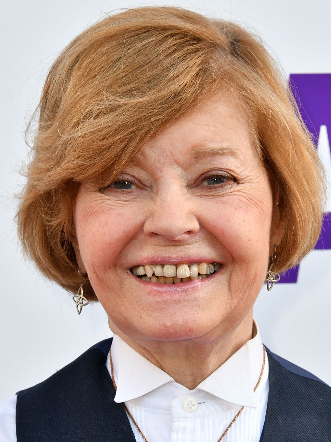 Prunella Scales Illness: What is Prunella Scales suffering from?