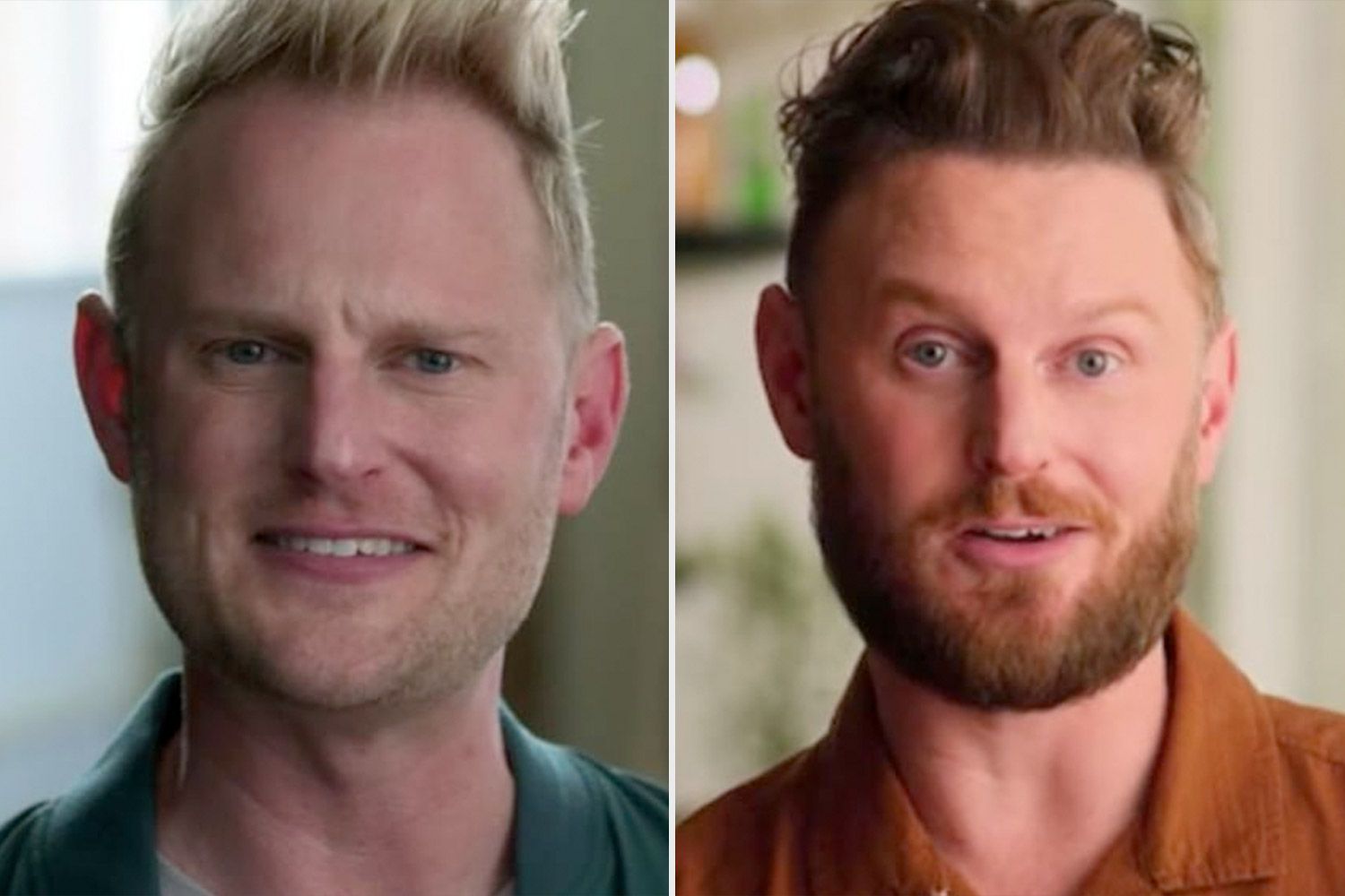 Has Bobby from Queer Eye had plastic surgery?