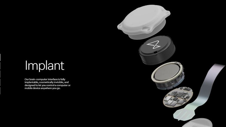 What is the goal of Neuralink? How does Neuralink work scientifically?