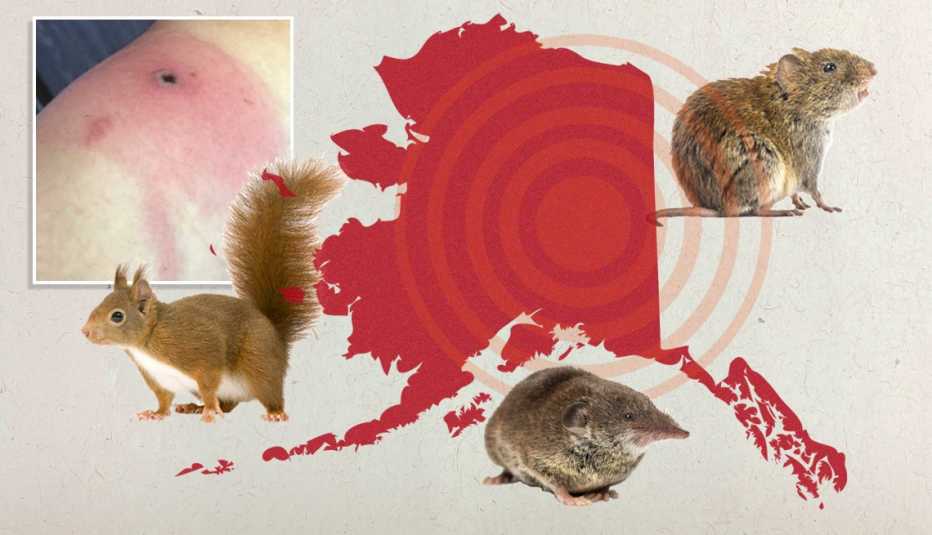 Alaskapox Virus: What is it?