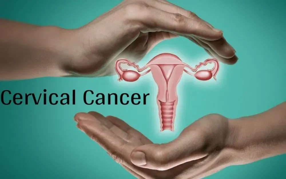 Is cervical cancer a big killer? Who carries cervical cancer?