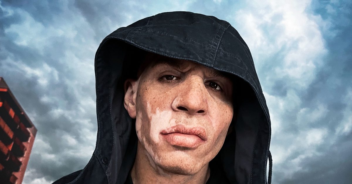 Casisdead Net Worth: How rich is Casisdead?