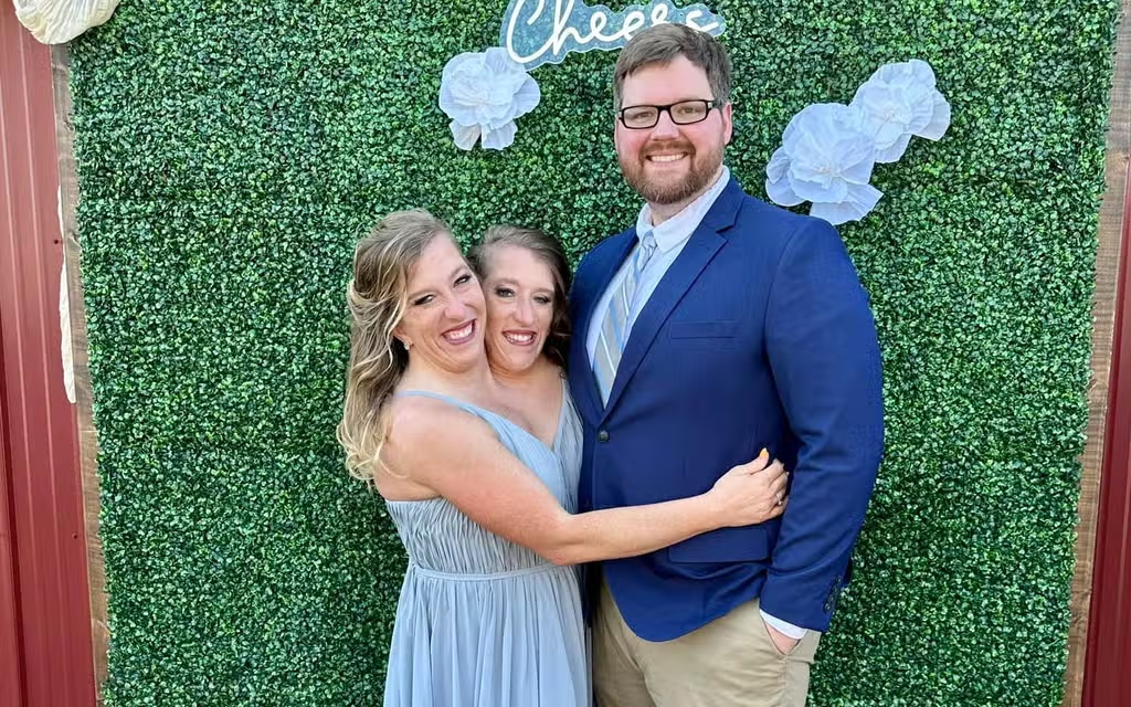 Conjoined Twins Abby Hensel Tie the Knot in a Private Ceremony