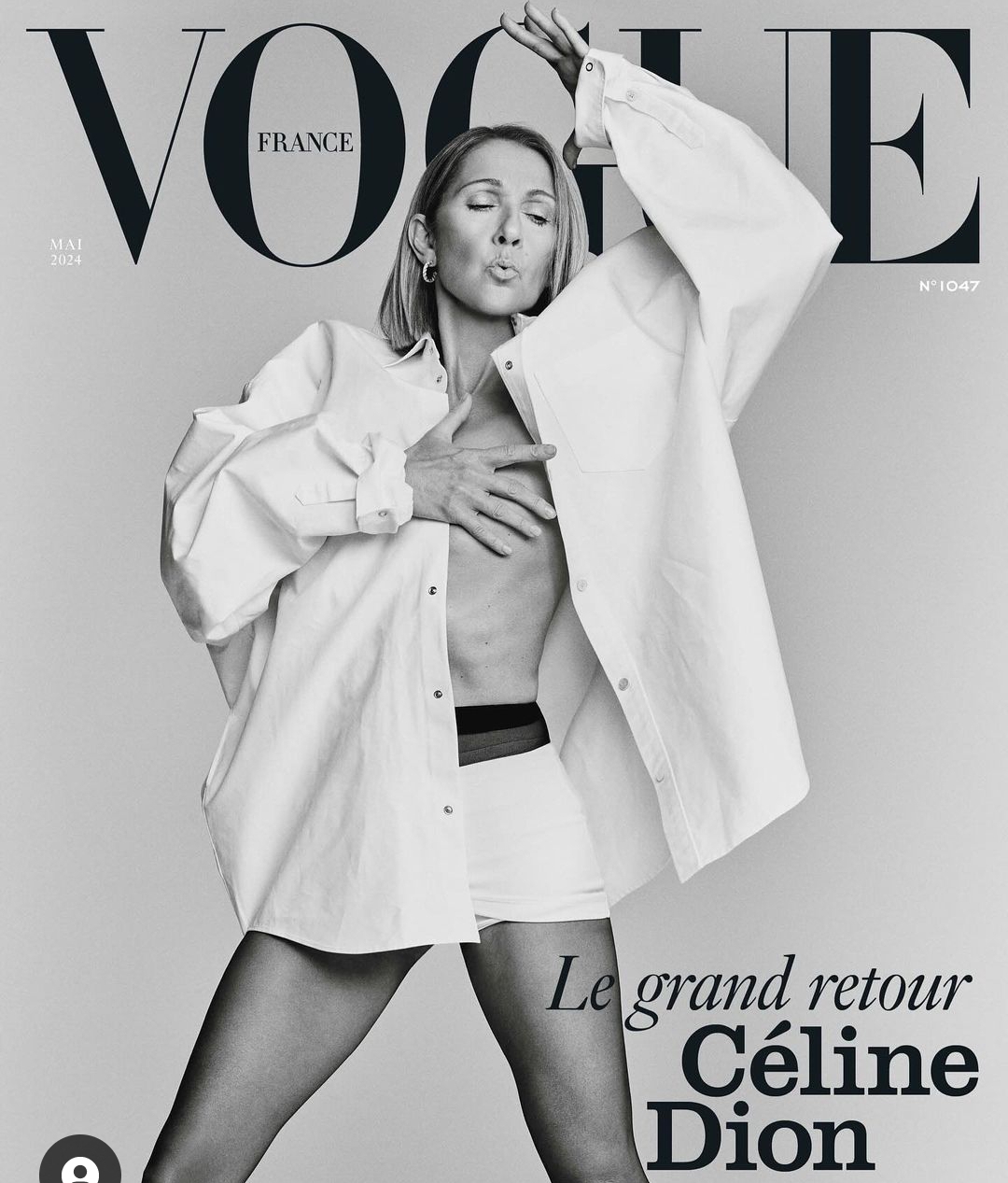 Celine Dion on the Cover of Vogue France 2024, as She Continues to Battle Illness That Halted Her Singing Career