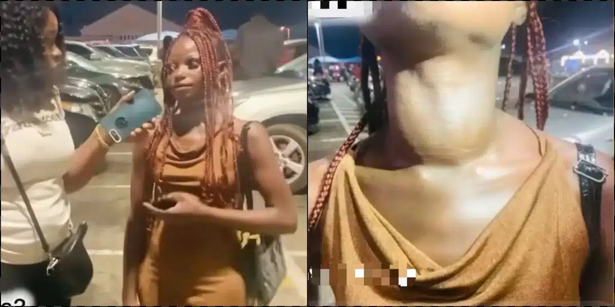 Nigerians Come Together to Raise Funds for Woman in Need of Goitre Surgery