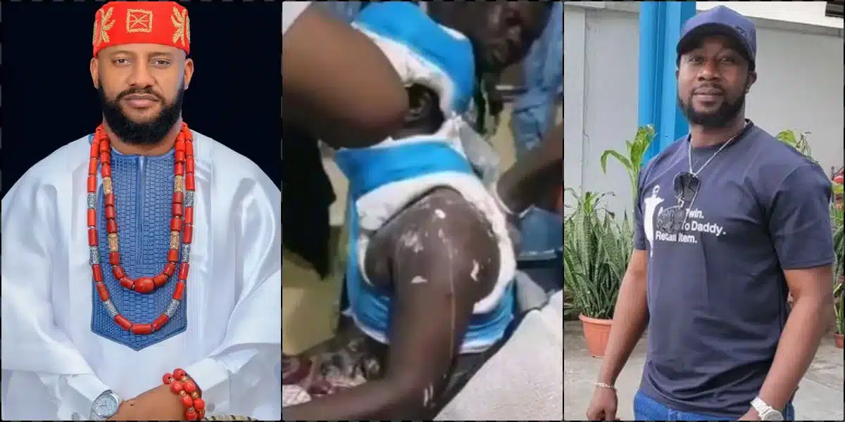 Yul Edochie  Calls for Help as Film Director Struggles with Spinal Cord Injury Following Accident