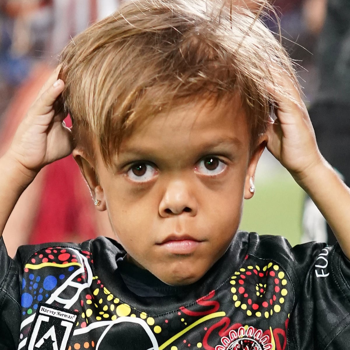 Meet Quaden Bayles, Bullied Boy with Dwarfism Cast in “Mad Max” film “Furiosa